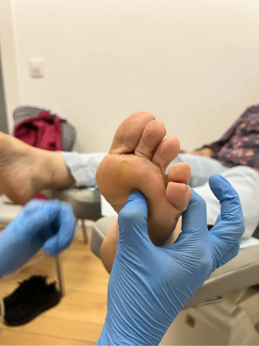 Neuroma de Morton Podologo Bilbao