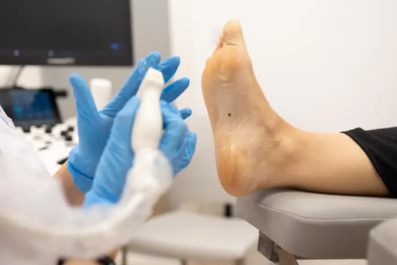 Ecografía Podológica