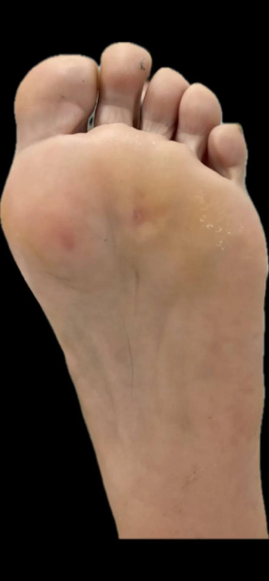 Evaluación biomecánica