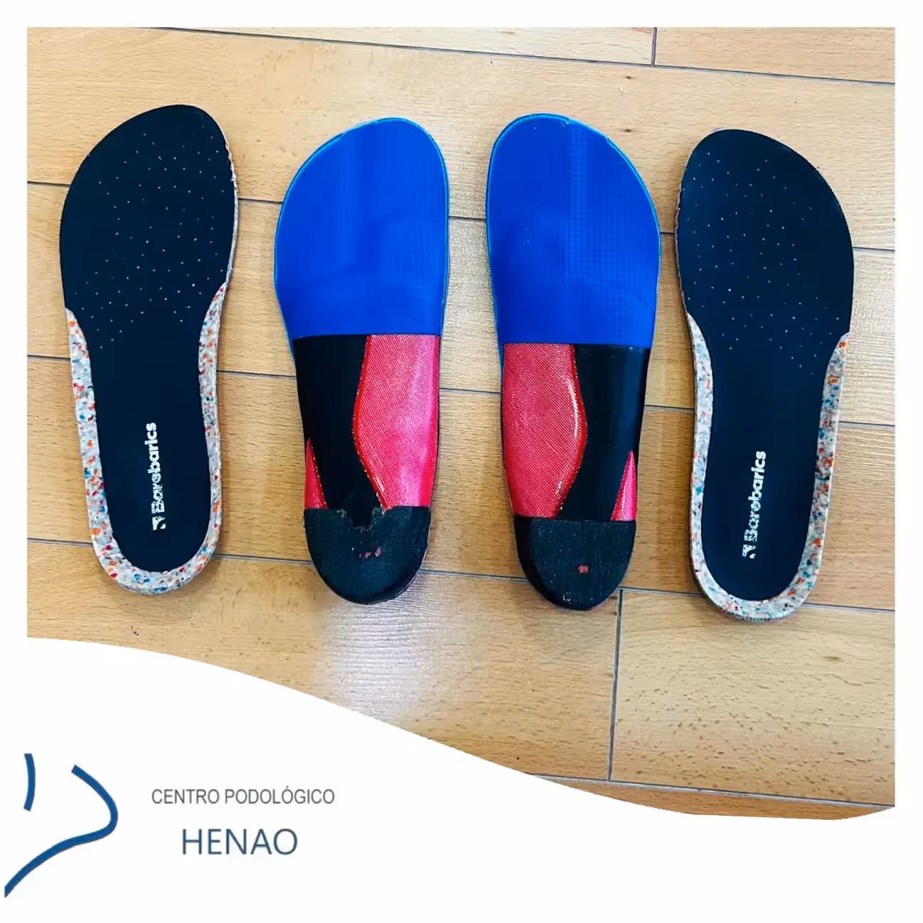 Plantillas personalizadas para juanetes en Bilbao