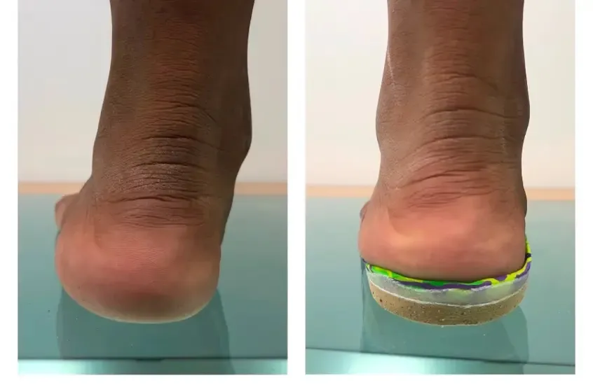 Podología infantil en Centro Podológico Henao Bilbao