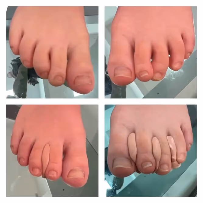 Diagnóstico podológico para el desarrollo saludable de los pies de los niños