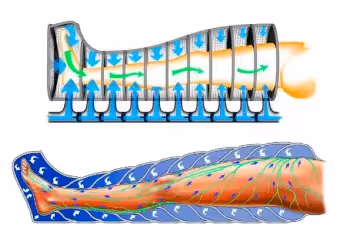 Tratamiento de presoterapia para mejorar circulación y reducir hinchazón